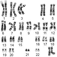 Chromosomes Involved in Color Blindness – Colblindor
